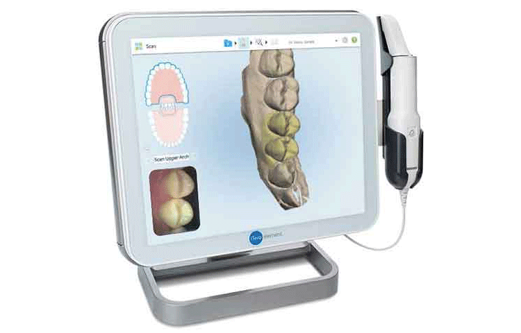 3Dで口腔内を正確にスキャンできるシステム導入