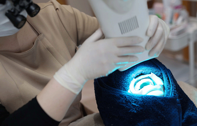 オフィスホワイトニング